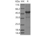 Human LECT1 Recombinant Protein (Fc Tag) (RPES0172)