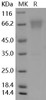 Mouse B7-H4/VTCN1 Recombinant Protein (aa 29-256, Fc Tag) (RPES0178)