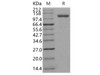 Human Endoglin/CD105 Recombinant Protein (Fc Tag) (Active) (RPES0199)