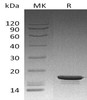 Human STMN1 Recombinant Protein (RPES0203)