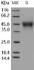Human CD16a/FCGR3A Recombinant Protein (RPES0212)