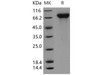 Human PROS1/Protein S Recombinant Protein (RPES0217)