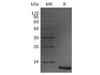 Human S100A11 Recombinant Protein (RPES0227)