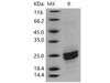 Mouse PLA2G12B/PLA2G13 Recombinant Protein (His Tag) (RPES0235)