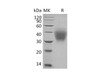 Human SCF/c-Kit Ligand Recombinant Protein (RPES0241)