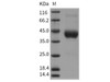 Rat FCGR1A/CD64 Recombinant Protein (RPES0242)