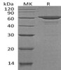 Human SOAT2/ACAT2 Recombinant Protein (RPES0260)