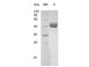 Mouse CD112/Nectin-2 Recombinant Protein (RPES0264)