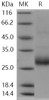 Human RANKL/TNFSF11 Recombinant Protein  (RPES0269)