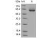 Human ENPP7/NPP-7 Recombinant Protein (RPES0270)