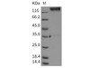 Rat LAMP1/CD107a Recombinant Protein (Fc Tag) (RPES0272)