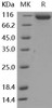 Mouse ASAH2 Recombinant Protein (RPES0274)