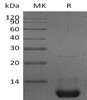 Mouse CXCL2/MIP-2 Recombinant Protein (RPES0282)