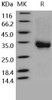 Human CD32a/FCGR2A Recombinant Protein (RPES0287)
