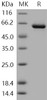 Human USP7/HAUSP Recombinant Protein (RPES0289)