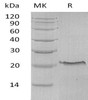 Human TNFR1/TNFRSF1A Recombinant Protein (HEK293 Cells, His Tag) (Active) (RPES0309)