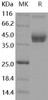 Mouse ALCAM/CD166 Recombinant Protein (His & Fc Tag) (Active) (RPES0313)