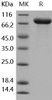 Human IL1R2/CD121b Recombinant Protein (Fc Tag) (Active) (RPES0315)