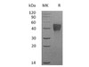 Mouse TROP2/TACSTD2 Recombinant Protein (RPES0325)