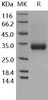Human CD32a/FCGR2A Recombinant Protein (RPES0326)
