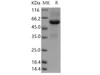 Human TMED1 Recombinant Protein (Fc Tag) (Active) (RPES0327)