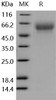 Human CD155/PVR Recombinant Protein (RPES0335)
