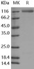 Human ECE-2 Recombinant Protein (His Tag) (RPES0350)