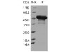 Mouse BLMH/BLM Hydrolase Recombinant Protein (RPES0352)