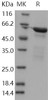Human NFkB p65 Recombinant Protein (RPES0354)