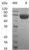 Human Neurotrimin/NTM Recombinant Protein (RPES0358)