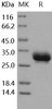 Human CD32a/FCGR2A Recombinant Protein (RPES0366)