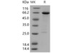Human HDAC8/HDACL1 Recombinant Protein (GST Tag) (RPES0367)
