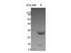 Human YKT6 Recombinant Protein (RPES0376)