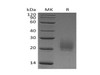Mouse CTLA4 Recombinant Protein (RPES0378)