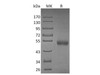 Mouse Osteoprotegerin Recombinant Protein (RPES0382)