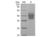 Human Cerberus/CER1 Recombinant Protein (RPES0393)