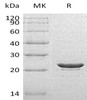 Human HSPB8 Recombinant Protein (RPES0394)