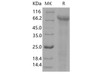 Human Jagged 1/JAG1 Recombinant Protein (RPES0405)