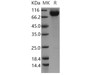 Human CDCP1/CD318 Recombinant Protein (Fc Tag) (RPES0424)