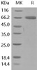 Human PD-L1/B7-H1/CD274 Recombinant Protein (RPES0432)