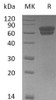 Mouse EDAR/DL Recombinant Protein (RPES0438)
