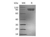 Human CD155/PVR/NECL5 Recombinant Protein (RPES0441)