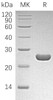 Human HPGDS/GSTS Recombinant Protein (RPES0453)