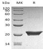 Human NGAL/Lipocalin-2 Recombinant Protein (RPES0454)