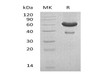 Mouse Ephrin-A1/EFNA1 Recombinant Protein (RPES0457)
