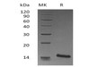 Mouse Trefoil Factor 1/TFF1 Recombinant Protein (RPES0461)