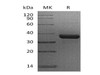 Human N-Glycosylase/OGG1 Recombinant Protein (RPES0472)