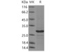 Human CD20/MS4A1 Recombinant Protein (RPES0480)