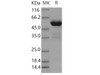 Human PPIase/FKBP7 Recombinant Protein (Fc Tag) (RPES0481)