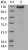 Mouse FGFR3 Recombinant Protein (His & Fc Tag) (Active) (RPES0487)